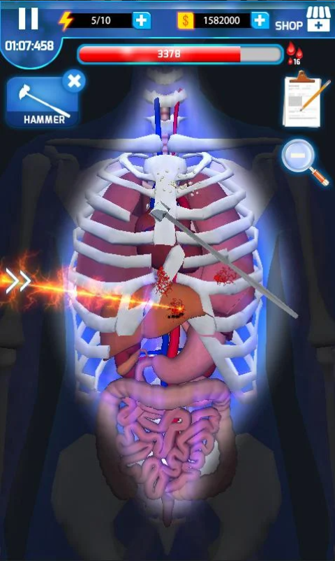 手术大师(SurgeryMaster)
